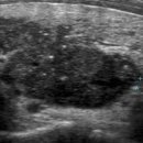 삼성숨소리이비인후과의원 이미지