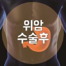 위암 수술 후 관리 어떻게 해야할까요 이미지