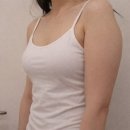 서초대로 49 | 365mc병원 교대점 팔뚝 무한람스 상담, 시술 당일 후기