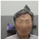 이지모맞춤가발 | 일산가발 부모님 효도선물
