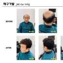 재구가발