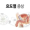 여자 왼쪽 오른쪽 아랫배 묵직 땡김 찌릿 통증 원인 이미지