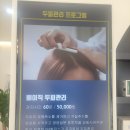 모락스칼프 이미지