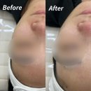 익산보떼 | 익산 | 세라링 스킨플래닝, 자극없는 피부관리 : 율샵