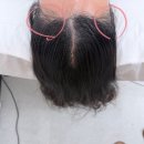 합정 헤어라인 교정을 위해 방문한 유주얼 비포&애프터 솔직후기