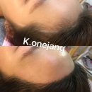 권헤어라인 이미지