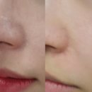 코 옆 각질 고민이라면? 촉촉한 즉각 진정 솔루션 스타라이크 피토 뮤신 캄 쿨 세럼