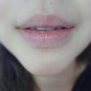 한림 생 약국 | 박탈성구순염치료기 #5 김광중교수와 두번째 만남//증상호전중♡