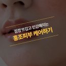 로즈아트스킨, 너도 피부관리의 매력을 느껴봐요!