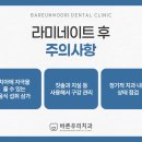 호암 e좋은치과의원 | 대구태전동치과 라미네이트, 최소삭제가 중요한가요?