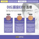 대구오즈피부과