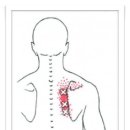 Rhomboid (능형근) 이미지