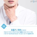 아띠아리 이미지