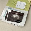 토비메모리 | 아기 초음파 앨범 4개 비교 후기 일상유희를 선택한 이유