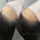 이미지헤어라인 이미지