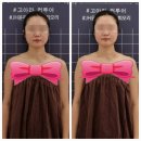 전주 혁신도시 만성동 피부관리샵, 고아라컨투어샵에서 JH 윤곽술 받은 후기
