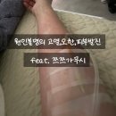 NR-1[경수대로]-상-898 | 원인불명 발열,오한,두통,피부발진 7일간의 투병 기록 및 상세후기 feat.쯔쯔가무시