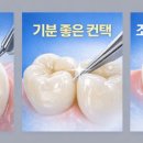 STL치과기공소 이미지