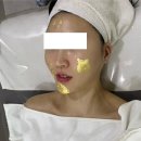 샤인피부관리실 - 고양시 일산서구 | 영등포시장역 가성비 피부관리실샤인에스테틱 3번째 재방문 LDM리프팅 골드테라피 후기
