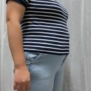 쇼니네네일맛집 | 고도비만 당일퇴원 대용량 4900cc 복부 지방흡입 통증 및 붓기관리 지흡 후기!