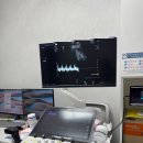 서울제일병원 | [임신 16주] 분당제일 여성병원 양수 검사 후기, 몽땅정보통 서울시 임산부 의료비 지원