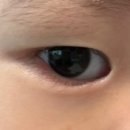 송탄하나안과의원 이미지