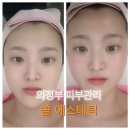 세븐일레븐 의정부센트럴타워점 | 의정부피부관리 쏠에스테틱에서 받은 얼굴윤곽관리 후기