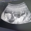 연세미여성의원 이미지