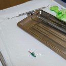 오치과의원 | 청라지구 &#39;오치과&#39; 솔직후기 (임플란트)