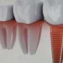 보석치과의원 이미지