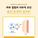 (주)우리메디칼 네이버블로그