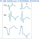 각차단 이미지