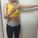 에스핏 | 에스핏주사 복부지방분해주사 3회차 후기