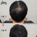 레이븐스칼프 이미지