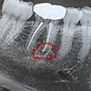 동탄센트럴치과병원 이미지