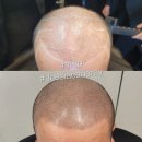 일산두피&눈썹단미토탈뷰티