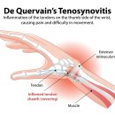 진주참신경외과의원 이미지