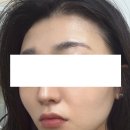 혁신도시 진입로 | [전주 만성동 얼굴빛에스테틱 이용후기] 전주 혁신도시 만성동 피부관리, 에스테틱 추천💞