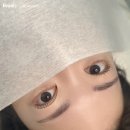 더모먼트 이미지