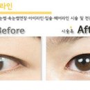 플로라 뷰티라인 이미지