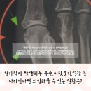 류마통내과의원 | 인천 부평구 통풍 류마티스내과 추천 이유와 꾸준한 약물 치료의 중요성