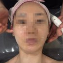 동탄솔빛로 | 동탄에스테틱ㅣ동탄 턱선 리프팅 관리 솔직 후기. 수앤미에스테틱