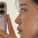 실로스 | 창원 코 실리프팅 잘하는곳_ 실*스의원 ) 코리프팅 받고 온 후기