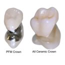 행복한 치과기공소 이미지