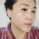 비움은 채움의 시작 展 | 행신 뷰티샵 비움과 채움에서 받아본 물방울초음파관리, 피부가 달라지는 느낌