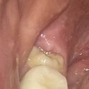 잠실숲사랑니구강악안면외과치과의원 이미지