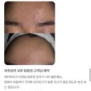 방배카페거리 2-9 | [서초 피부샵] 방배카페거리 여드름 압출 잘하는 트러블 피부 전문 제리라이크