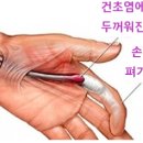 오창수지 이미지