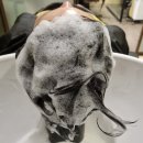 고운세상김양제장봉석피부과의원 | 내돈내산 부산탈모클리닉 고운세상 김양제피부과 체험 후기