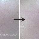 디케이스킨 이미지